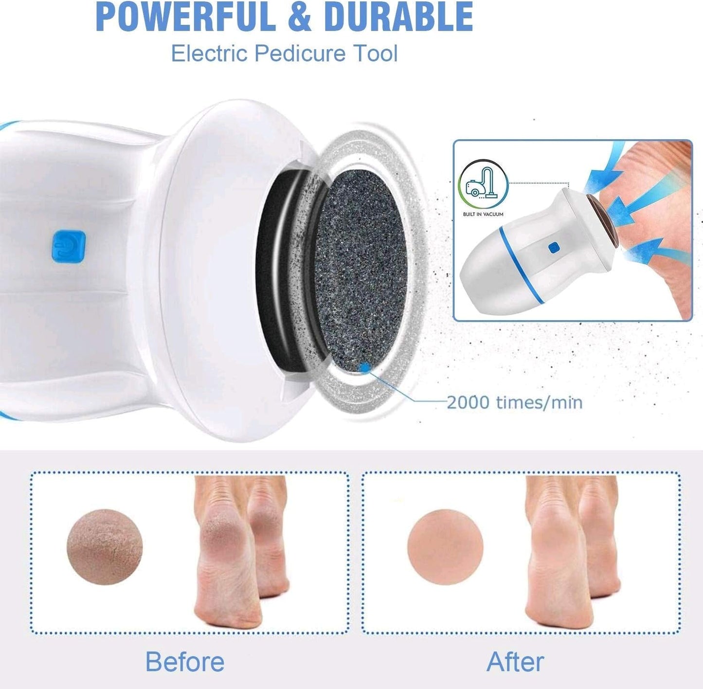 Electric Foot Grinder
