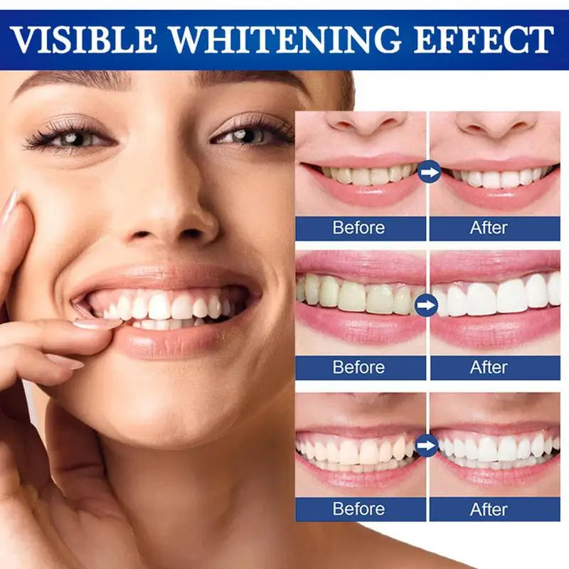 Teeth Whitening Pen